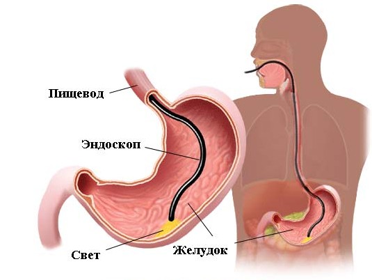 Проведение эндоскопии