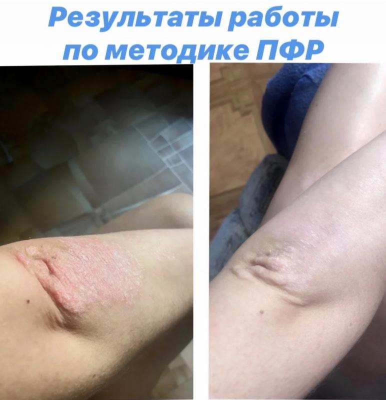 Психо-функциональная разблокировка